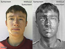 تصویر سمت چپ: استفاده از کرم ضدآفتاب فقط در نیمه سمت چپ چهرهتصویر سمت راست: در نمایش پرتوگرافی UV سمت چپ چهره همان بخشی است که در آن از کرم ضدآفتاب استفاده گردید